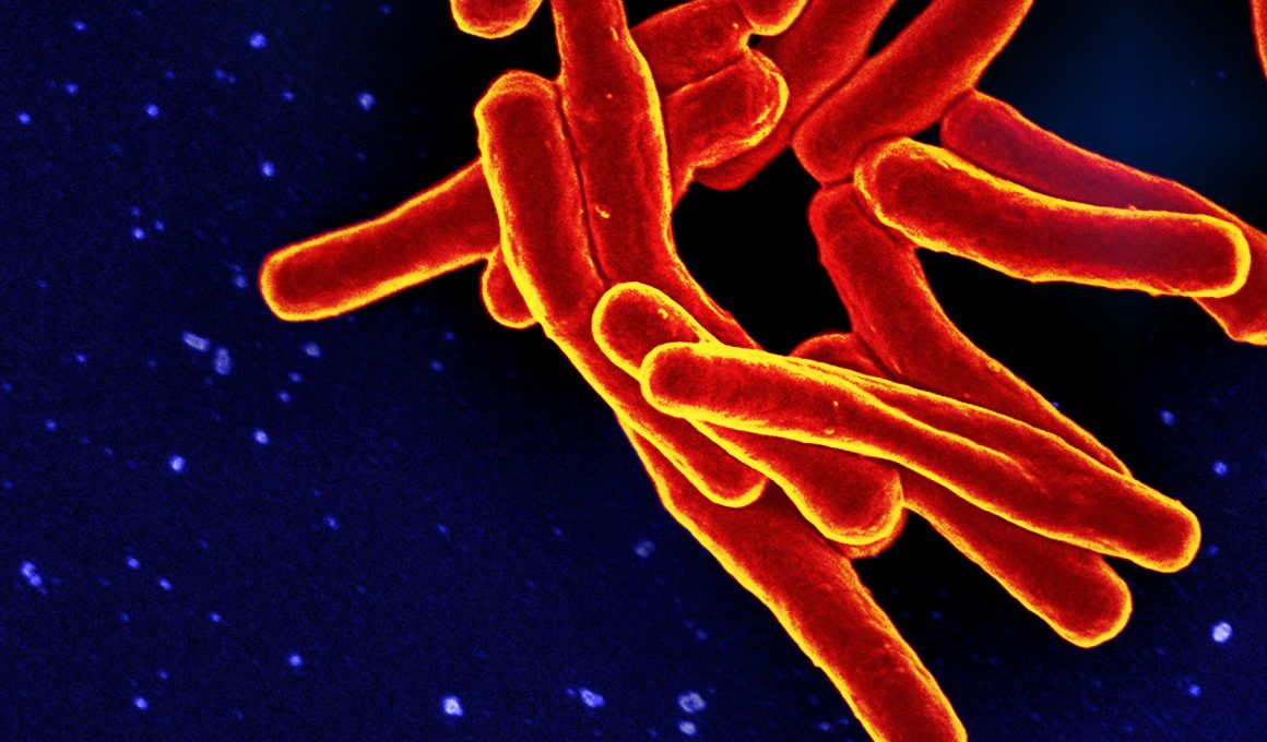 Photo of TB bacteria