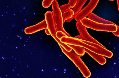 Photo of TB bacteria