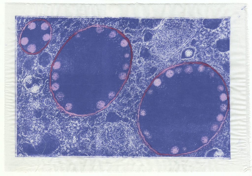Artistic rendering of a pathogen