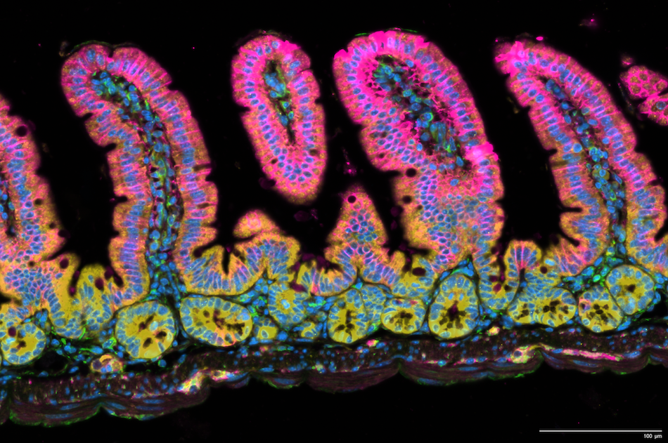 Microscopy image with a background. Cells are colored in shades of pink, blue, orange, green, red, and blue to depict differences in gene transcription.
An image produced through Xenium analysis of mouse small intestines. Protruding “villi” stick up from the lining of the small intestine. Valley-like “crypts” fill in the gaps.